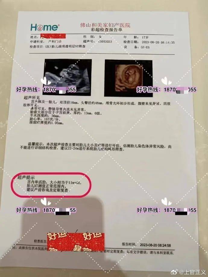 17岁彝族少女被曝为50岁男子代孕<strong></p>
<p>门罗币app</strong>，今年2月产下双胞胎