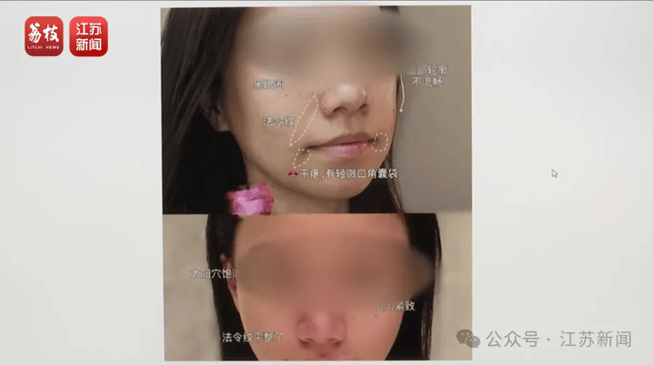打一针“返老还童”的童颜针卖了30亿<strong></p>
<p>tokenpocket官方下载</strong>，真的有效吗？