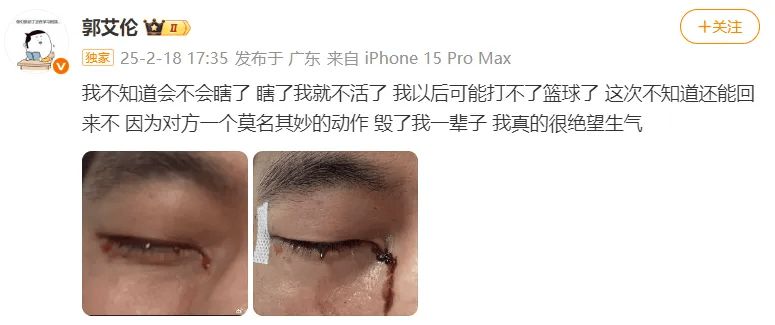 31岁郭艾伦直言想回国家队<strong></p>
<p>xlm币</strong>，但应该没什么机会了，此前眼睛被队友误伤，缝了40多针