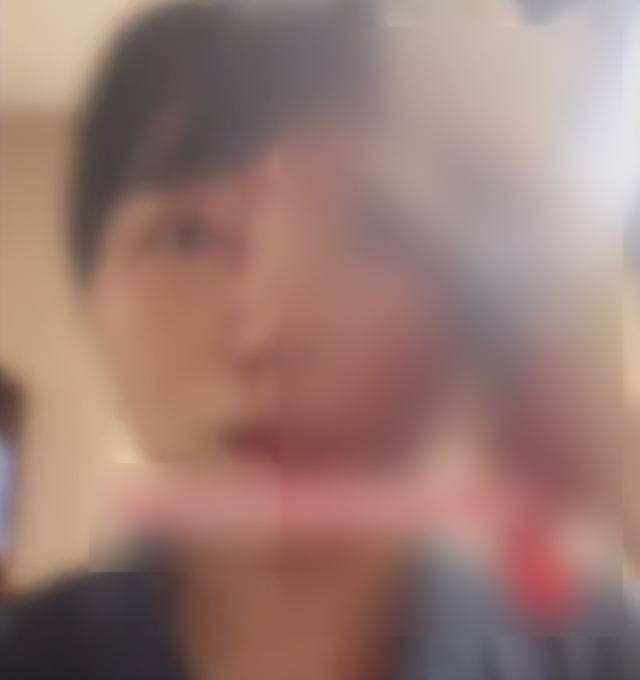 缝了20多针！女子称被不知名男同事砸头毁容<strong></p>
<p>xmr币</strong>，警方介入
