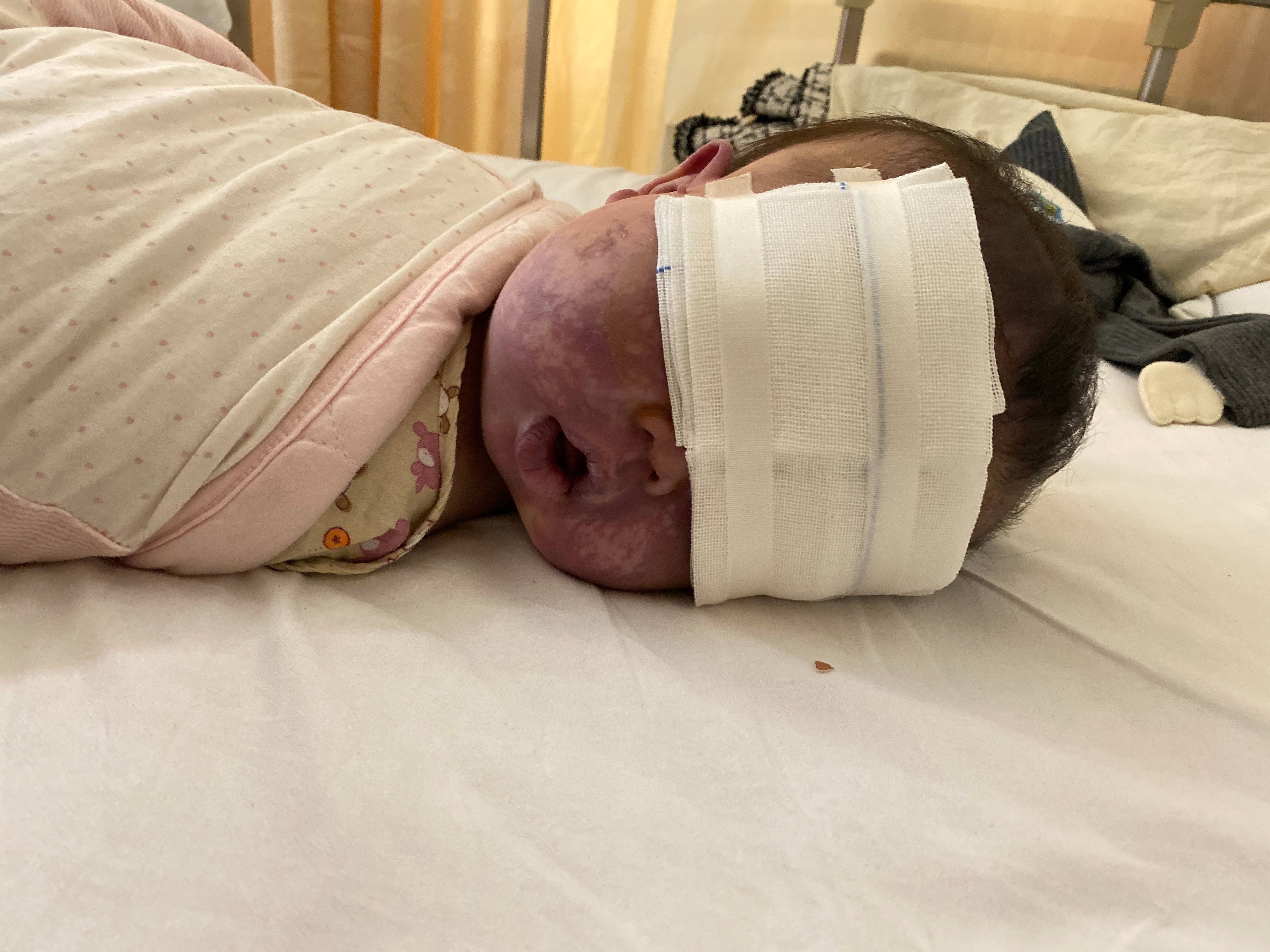 上饶6岁女童患病满身红斑<strong></p>
<p>xrp</strong>，初上幼儿园妈妈字里行间满是担心：曾经绝望，现在能看到光