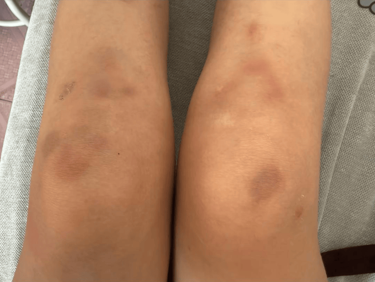 女子自称因工资问题被老板锁办公室里打 警方：双方已到派出所<strong></p>
<p>atom</strong>，是否打人还在调查