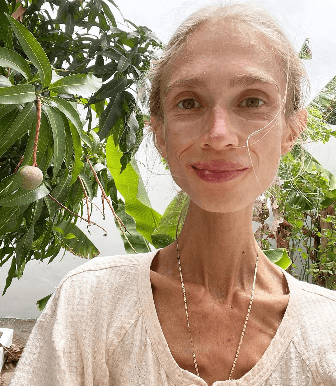 坚持只吃水果8年<strong></p>
<p>atom币</strong>,27岁波兰女子巴厘岛酒店去世:体重仅22公斤,指甲变黄牙齿腐烂