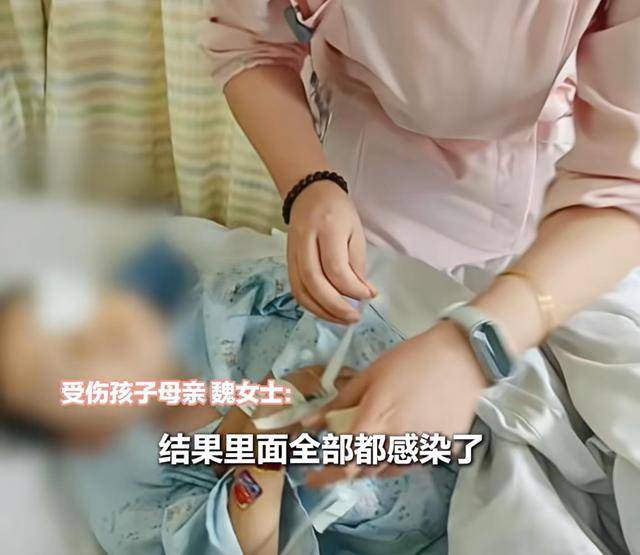 江西一5岁男孩在幼儿园被戳伤致左眼失明<strong></p>
<p>bch最新价格</strong>，家长称老师用猪油涂抹试图消肿