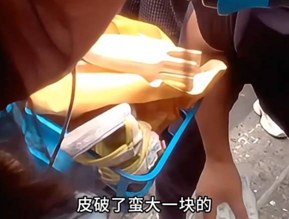 看着都疼<strong></p>
<p>FIL</strong>！上海街头一男子突然求助：10岁女儿被死死卡住！这个行为太危险→