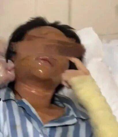 湖南一女主播被伪装的包裹炸伤<strong></p>
<p>FIL</strong>，永州公安：正在核实具体情况